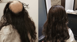 KBXvPlqsOL3lChknrebs_05_1d89f8eb45cdfaf44493c350048b0600_image.png - Replacement Hair-illustrateur
