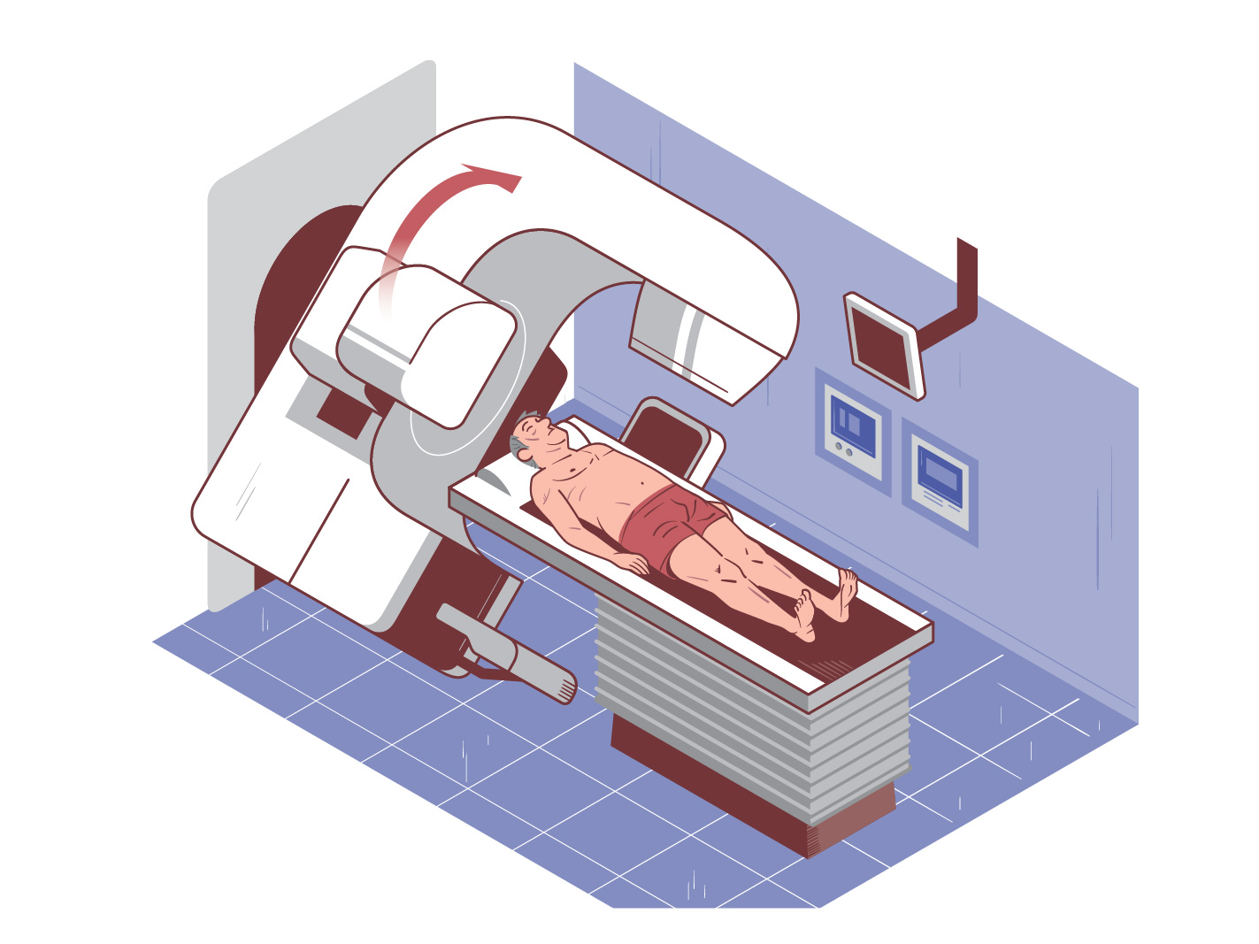 Vivio :: Atlas médical cancer colorectal